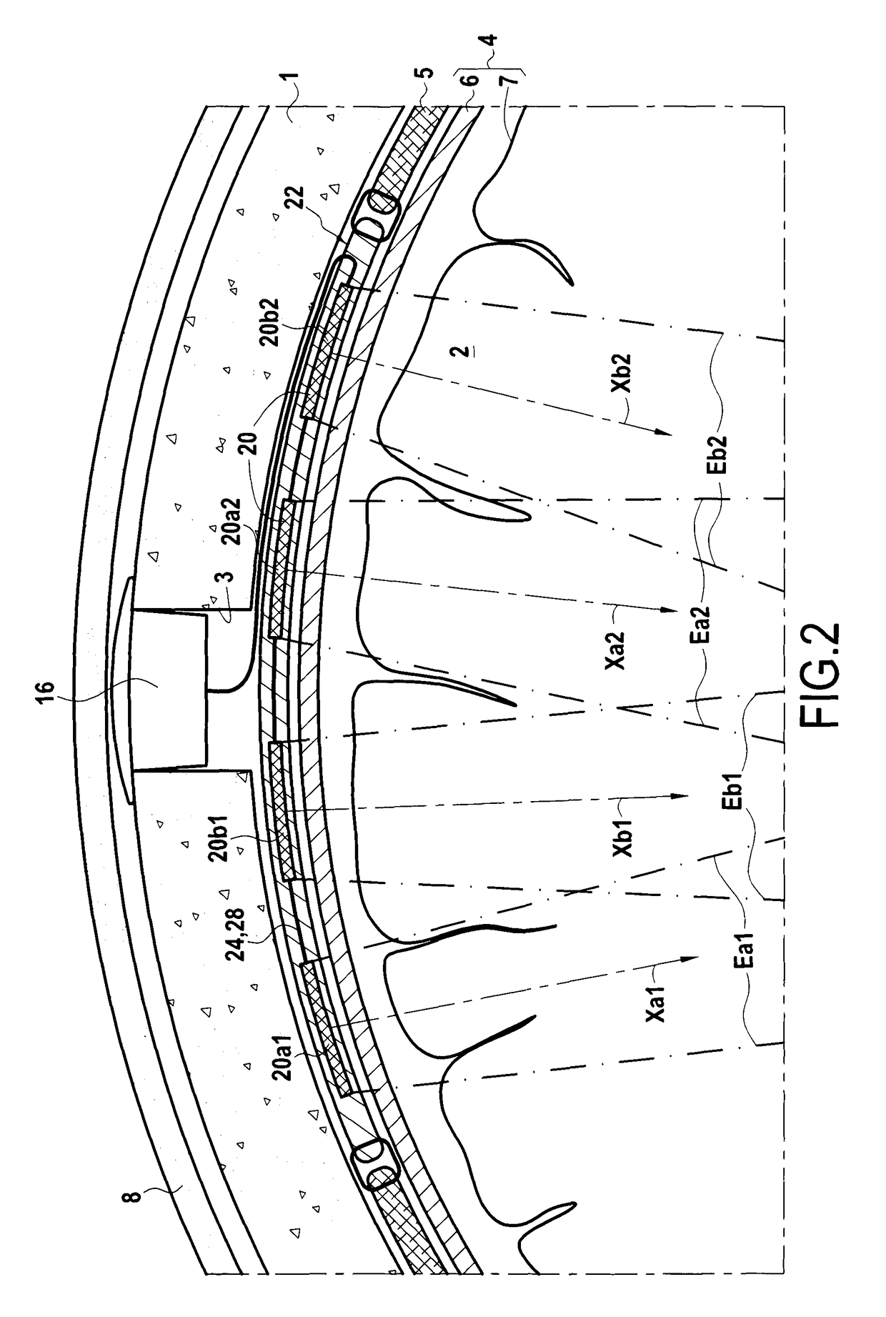 Implantable ultrasound generating treating device for brain treatment, apparatus comprising such device and method implementing such device