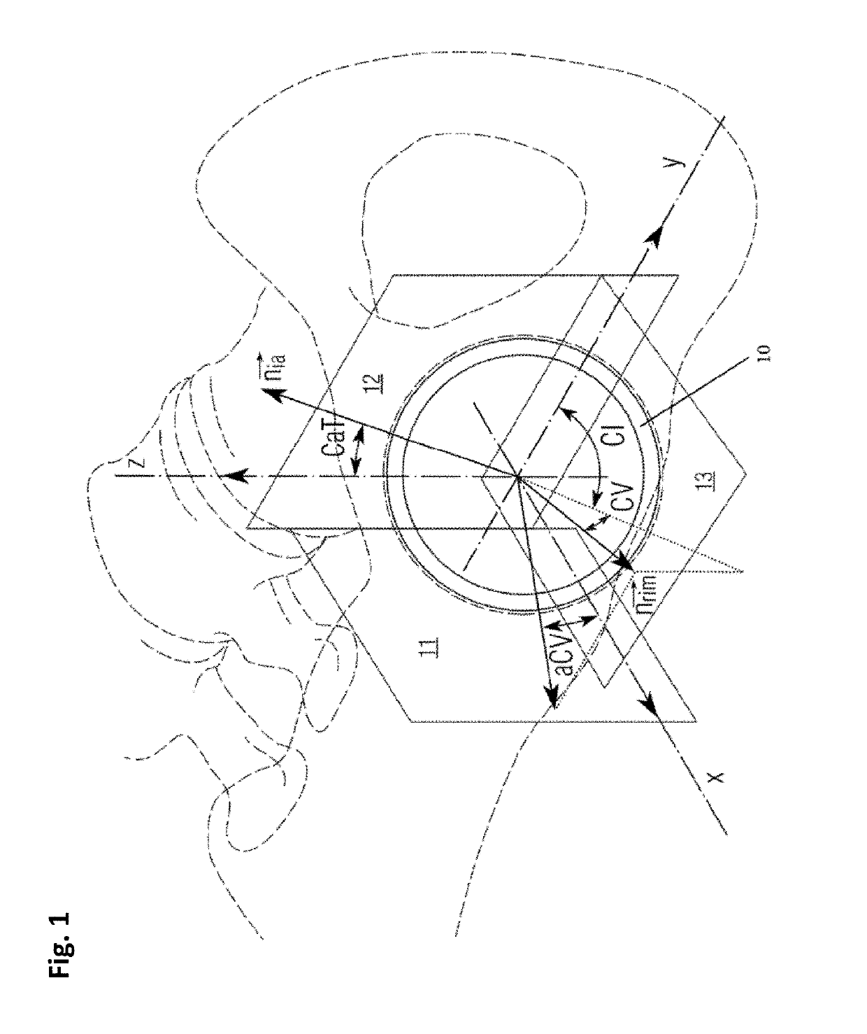 Fluoroscopy-Based Measurement and Processing System and Method