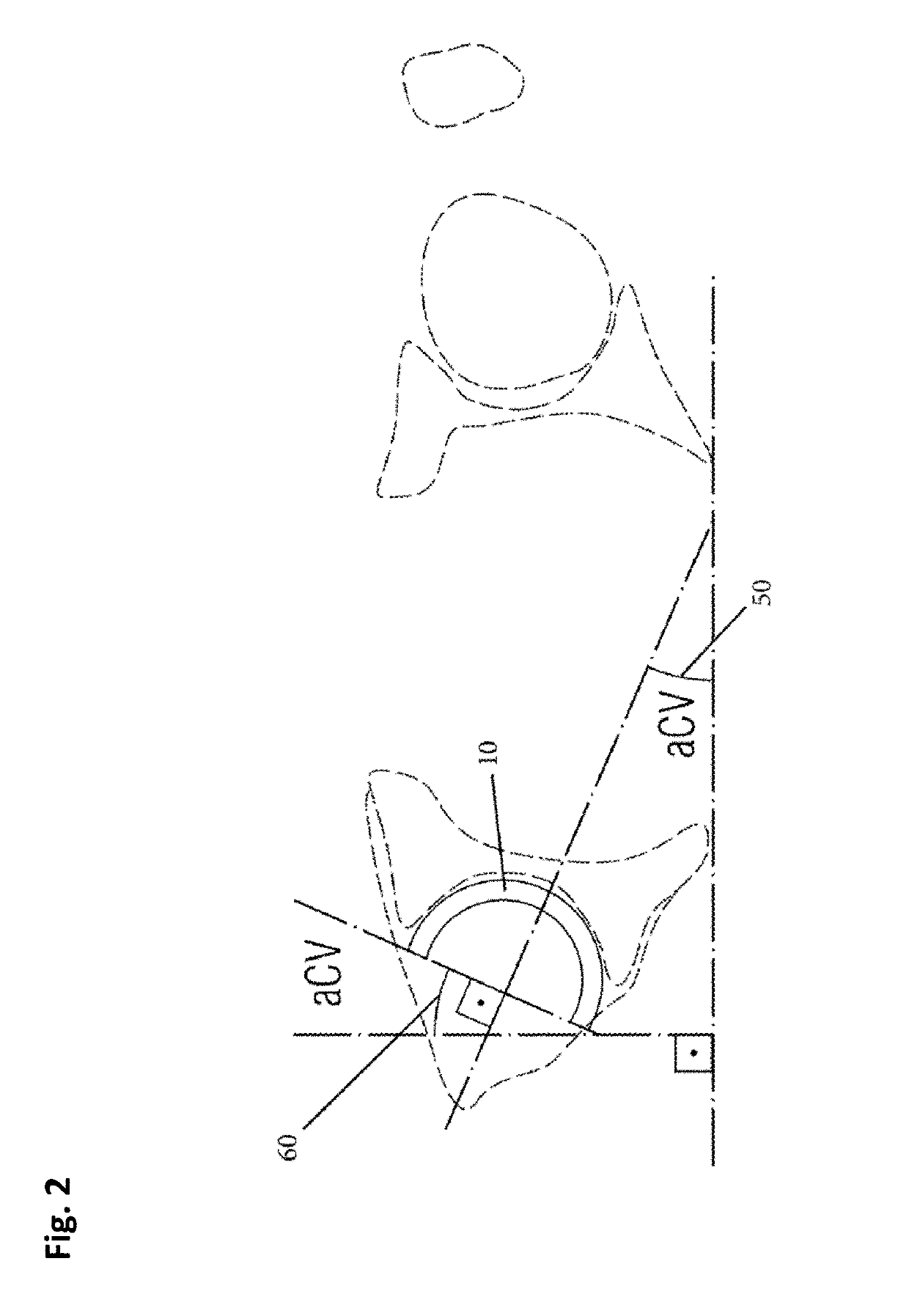 Fluoroscopy-Based Measurement and Processing System and Method