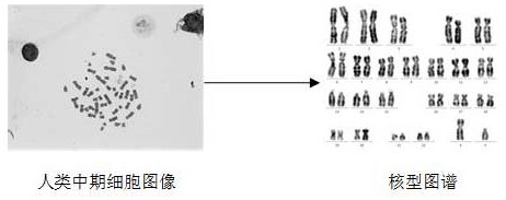 Chromosome karyotype analysis system