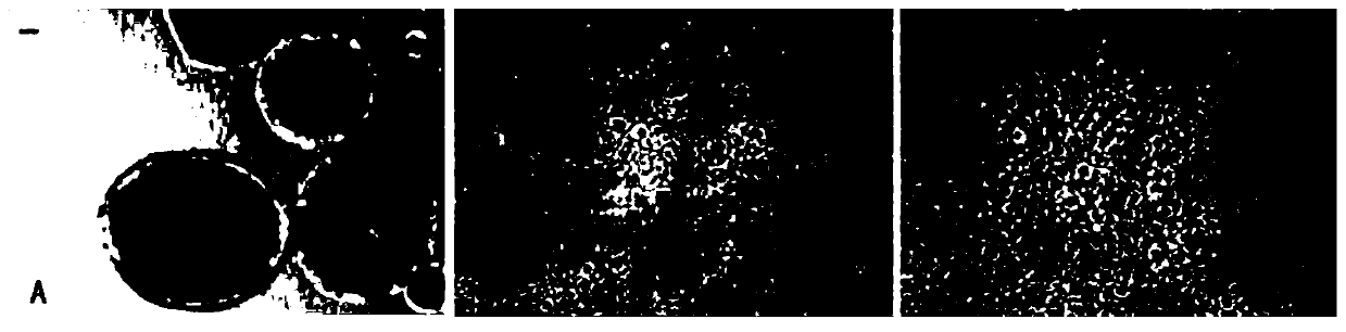 Method for obtaining corneal endothelial cells