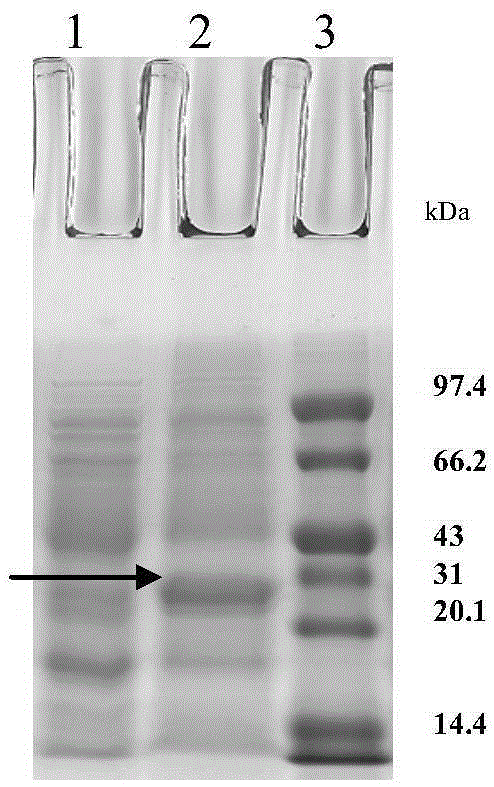 Rare codon modified human znf580 gene, prokaryotic expressed protein and polyclonal antibody