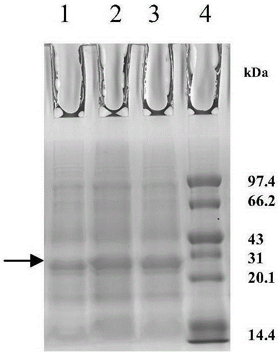 Rare codon modified human znf580 gene, prokaryotic expressed protein and polyclonal antibody