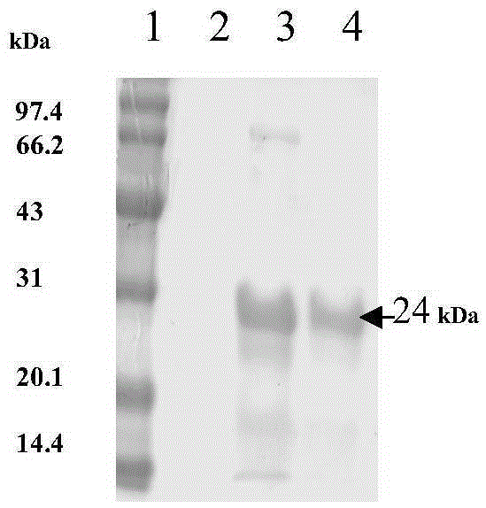 Rare codon modified human znf580 gene, prokaryotic expressed protein and polyclonal antibody