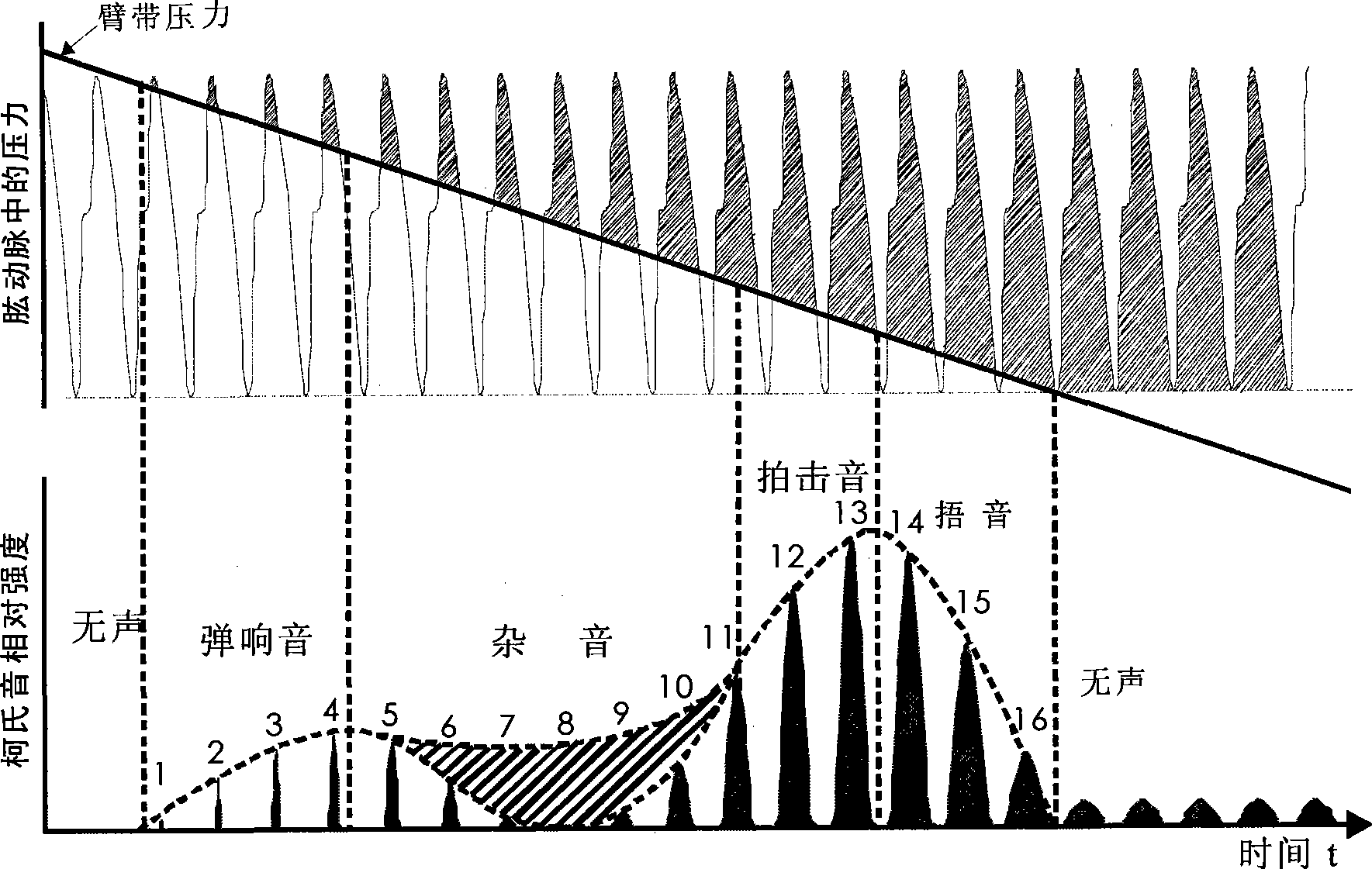 Human blood-pressure Korotkoff's high intensity image instrument