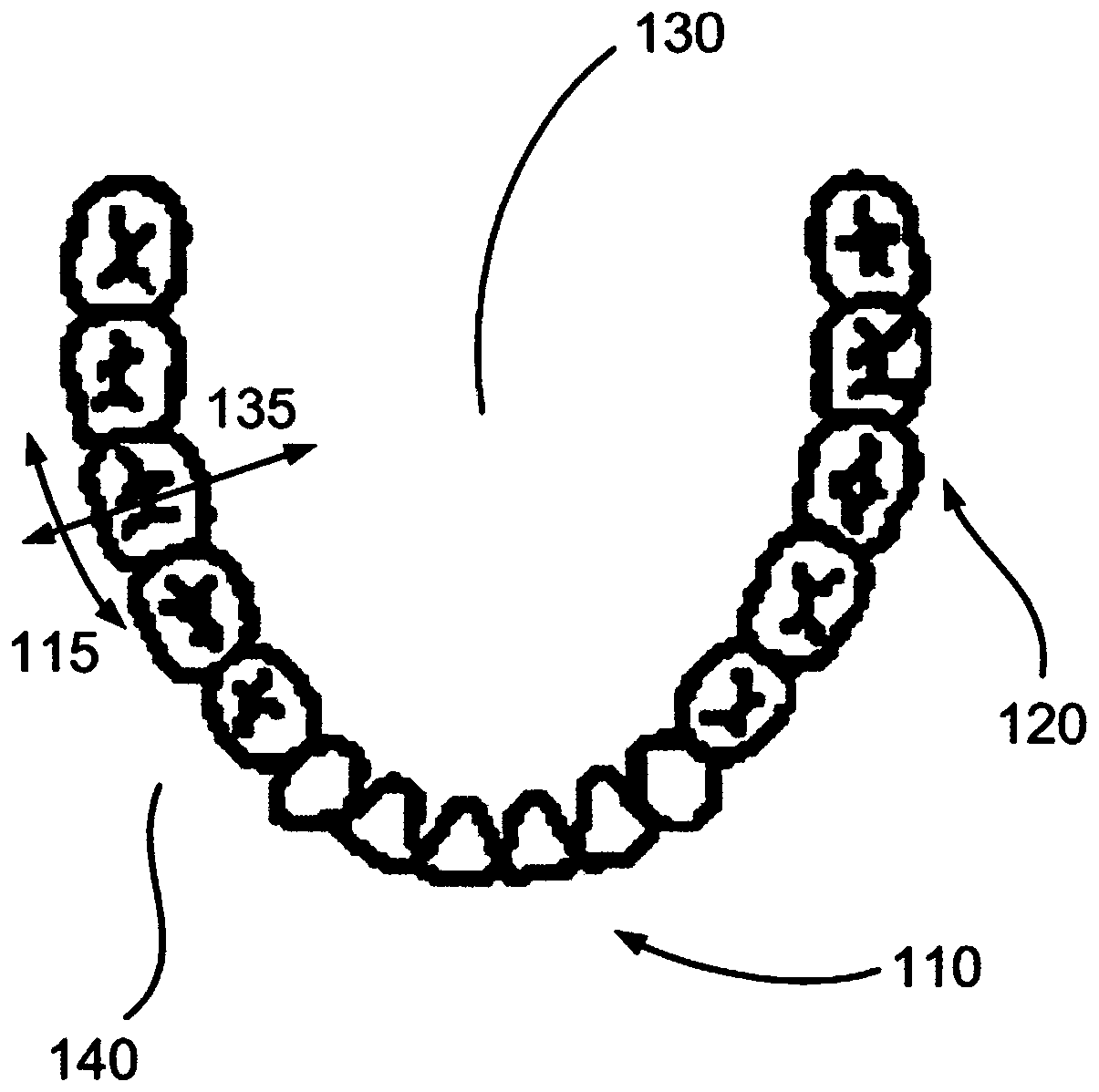 An orthodontic device