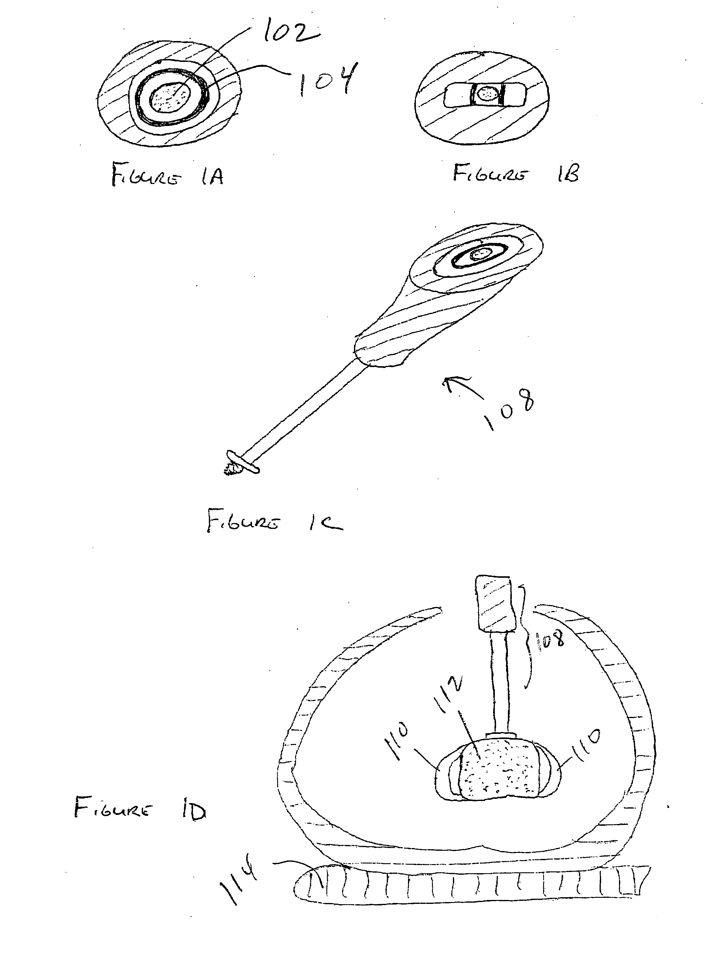 Methods and apparatus for artificial disc replacement (ADR) insertion and other surgical procedures