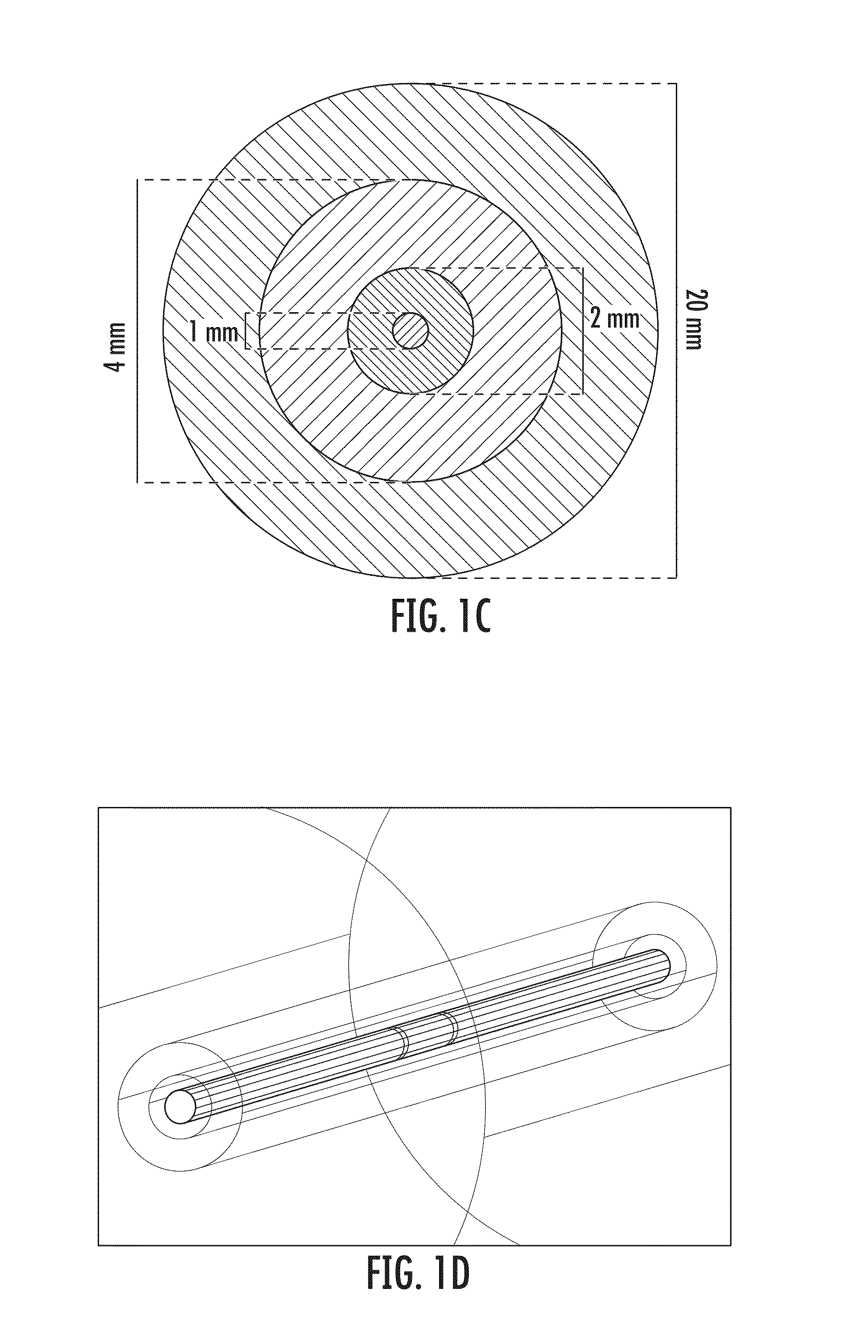 Device and Method for Electroporation Based Treatment of Stenosis of a Tubular Body Part