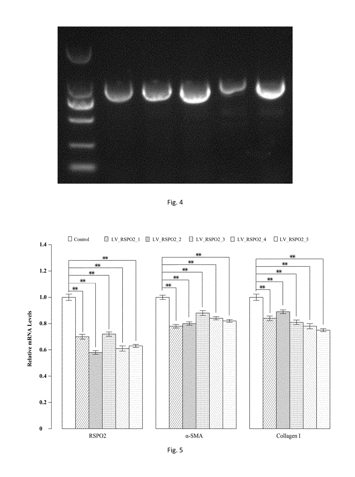 sgRNA and knockout method of human RSPO2 gene targeted with CRISPR-Cas9 specificity and application thereof