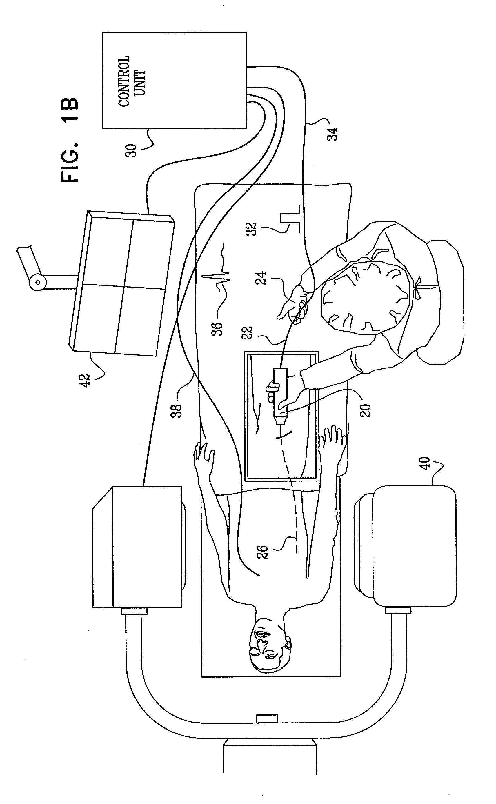 Stepwise advancement of a medical tool