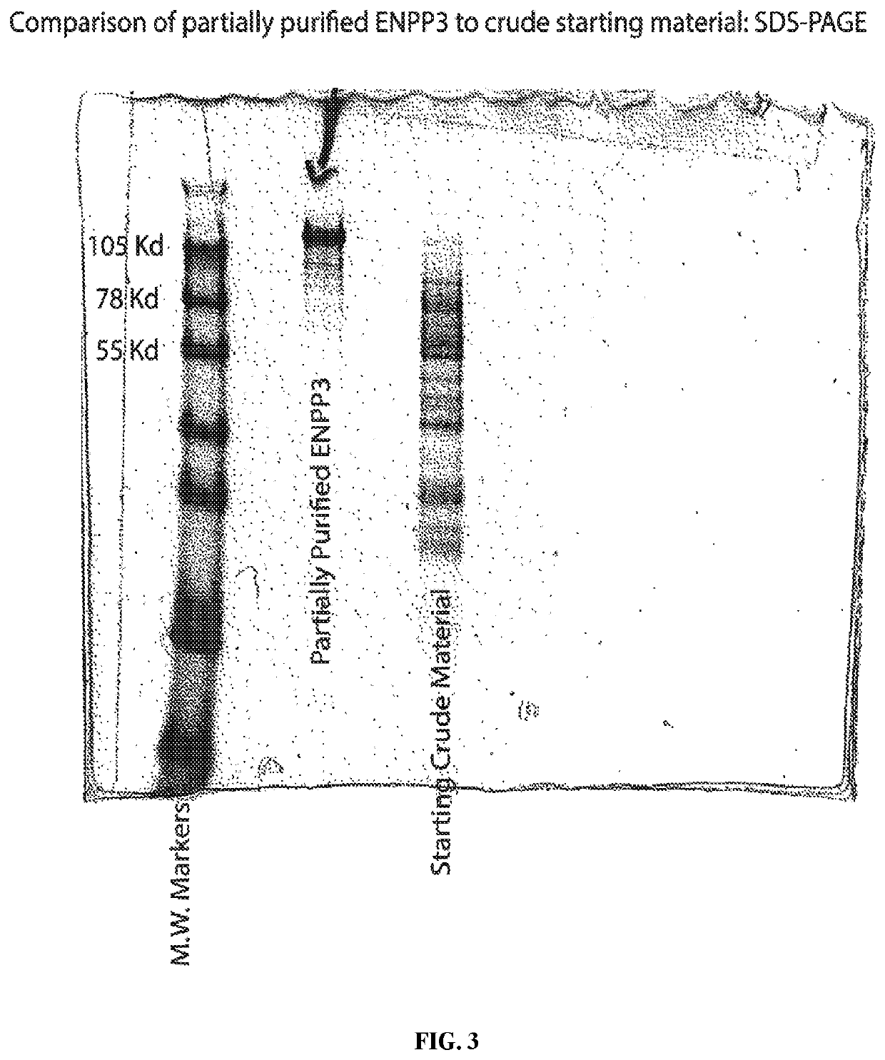 Compositions and methods for stroke prevention in pediatric sickle cell anemia patients