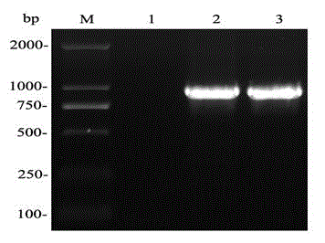Streptococcus pneumoniae autolysin small fragment gene expression protein, preparation method and application thereof