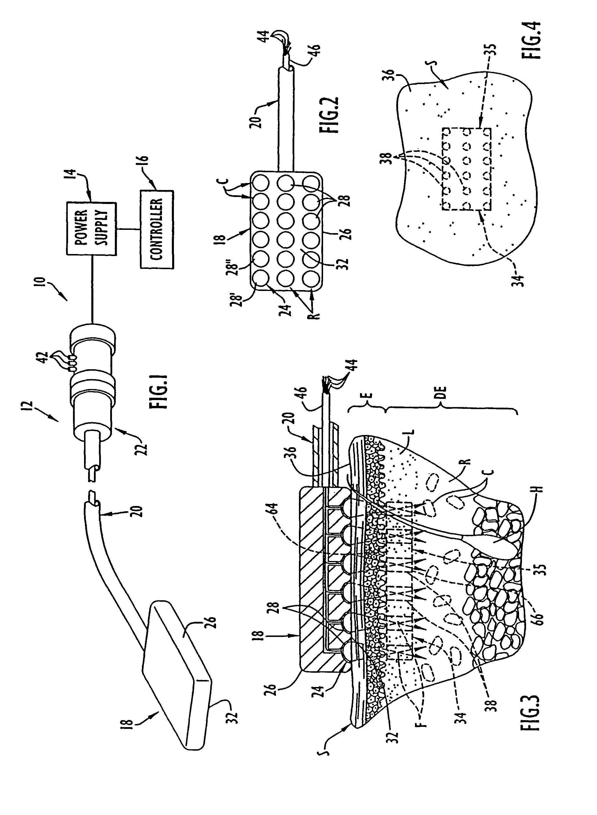 Method for guiding a medical device
