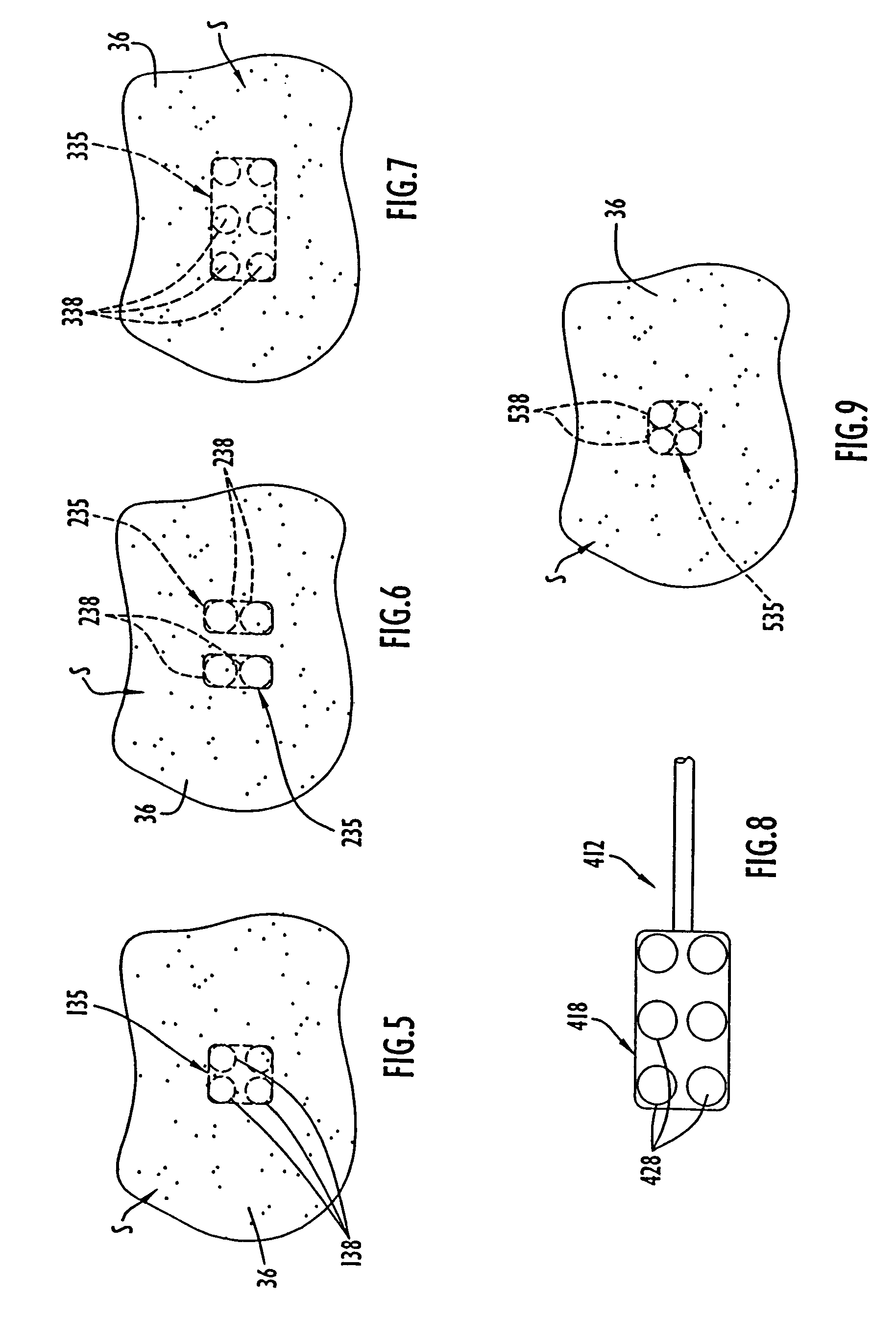 Method for guiding a medical device