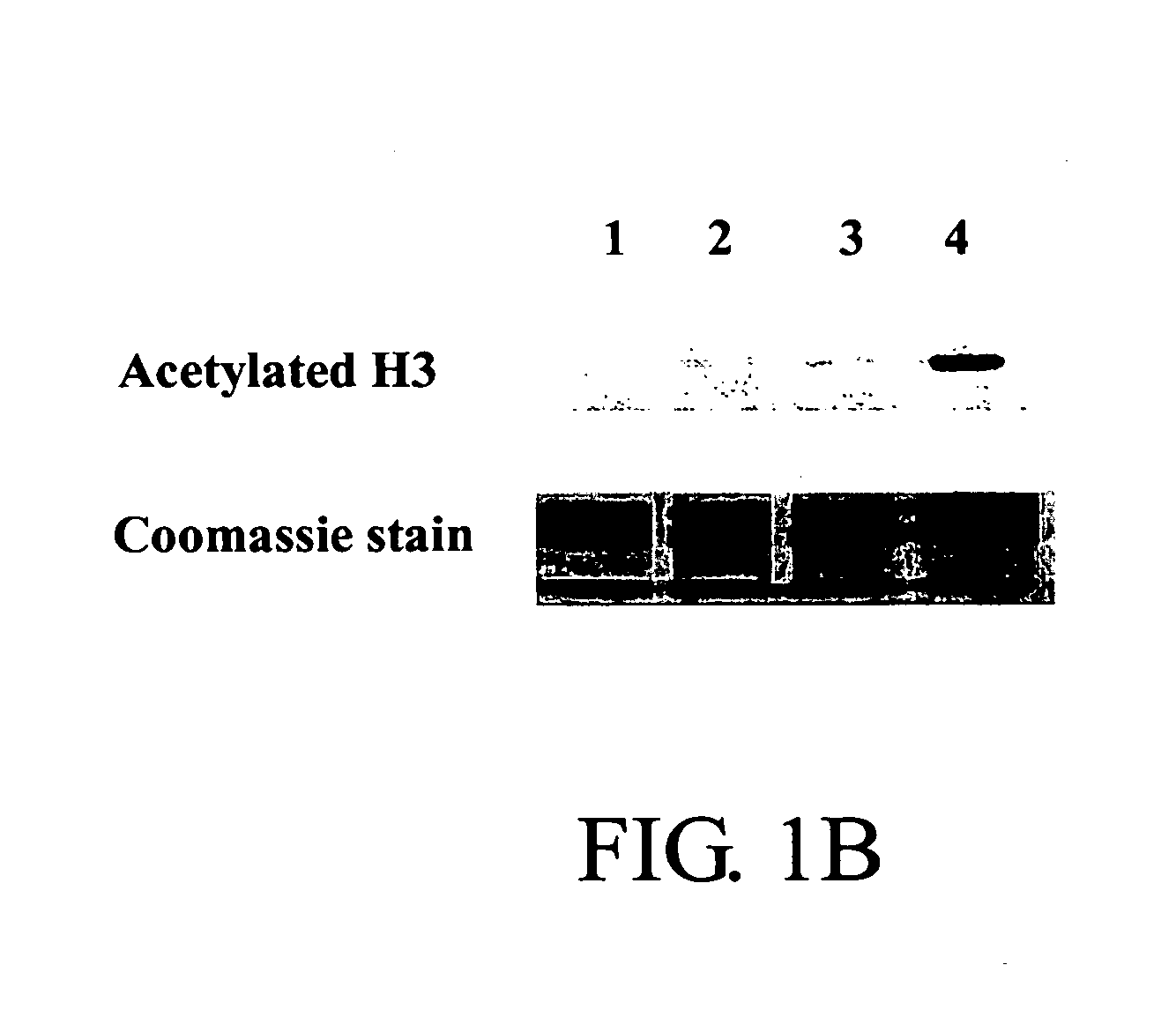 Histone hyperacetylating agents for promoting wound healing and preventing scar formation
