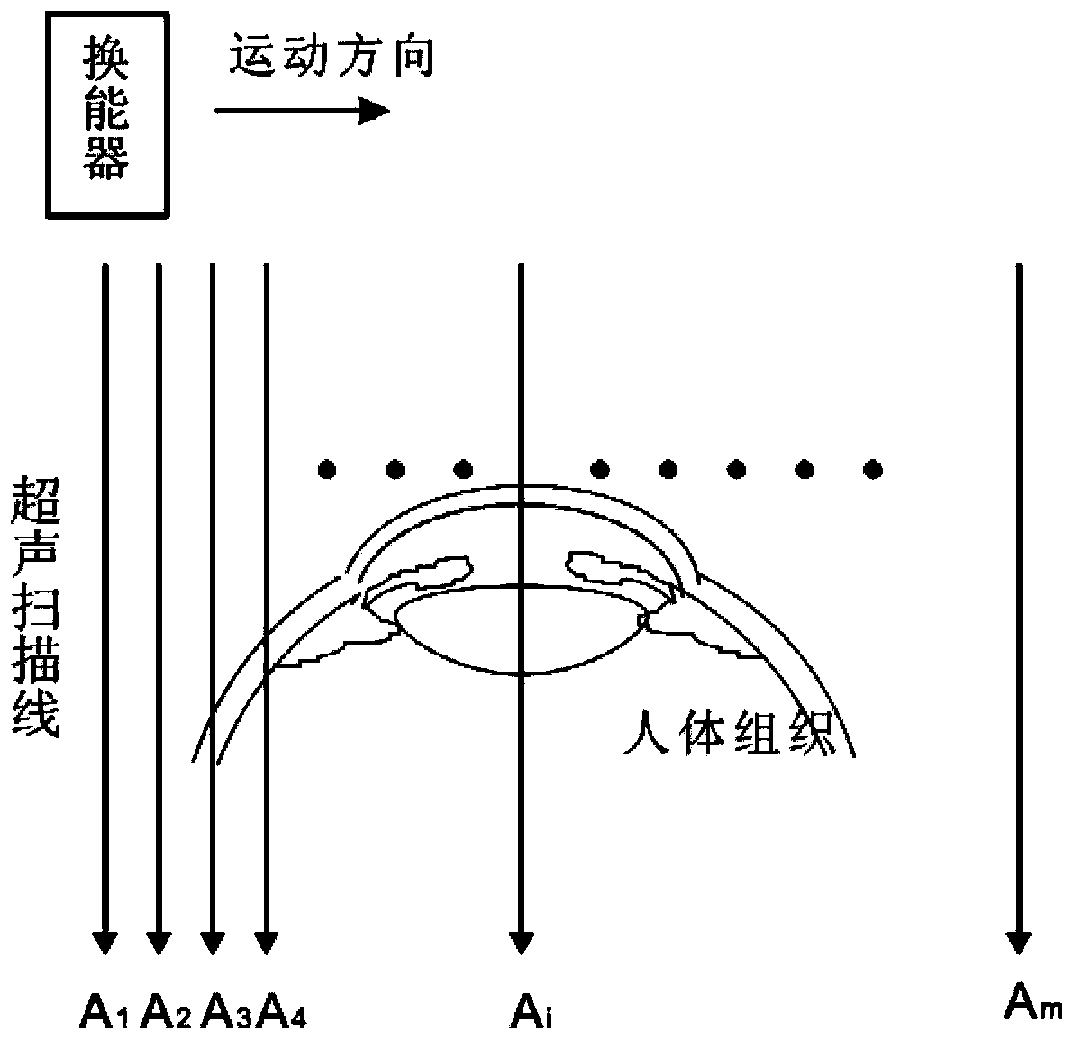 High-frequency ultrasonic superficial organ imaging method capable of lowering random noise