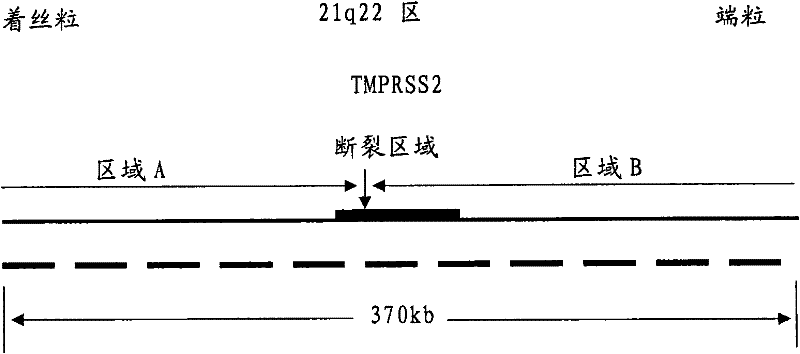 Detection agent for detecting prostate cancer and application thereof