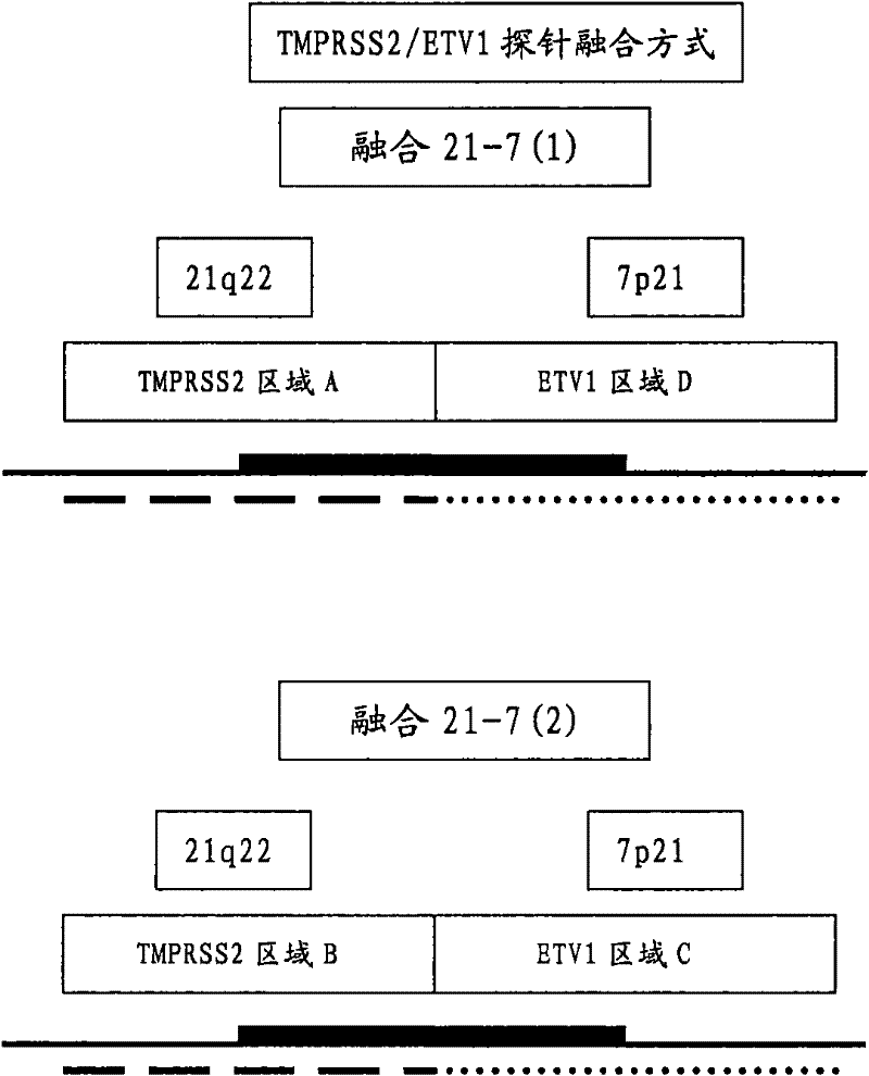 Detection agent for detecting prostate cancer and application thereof