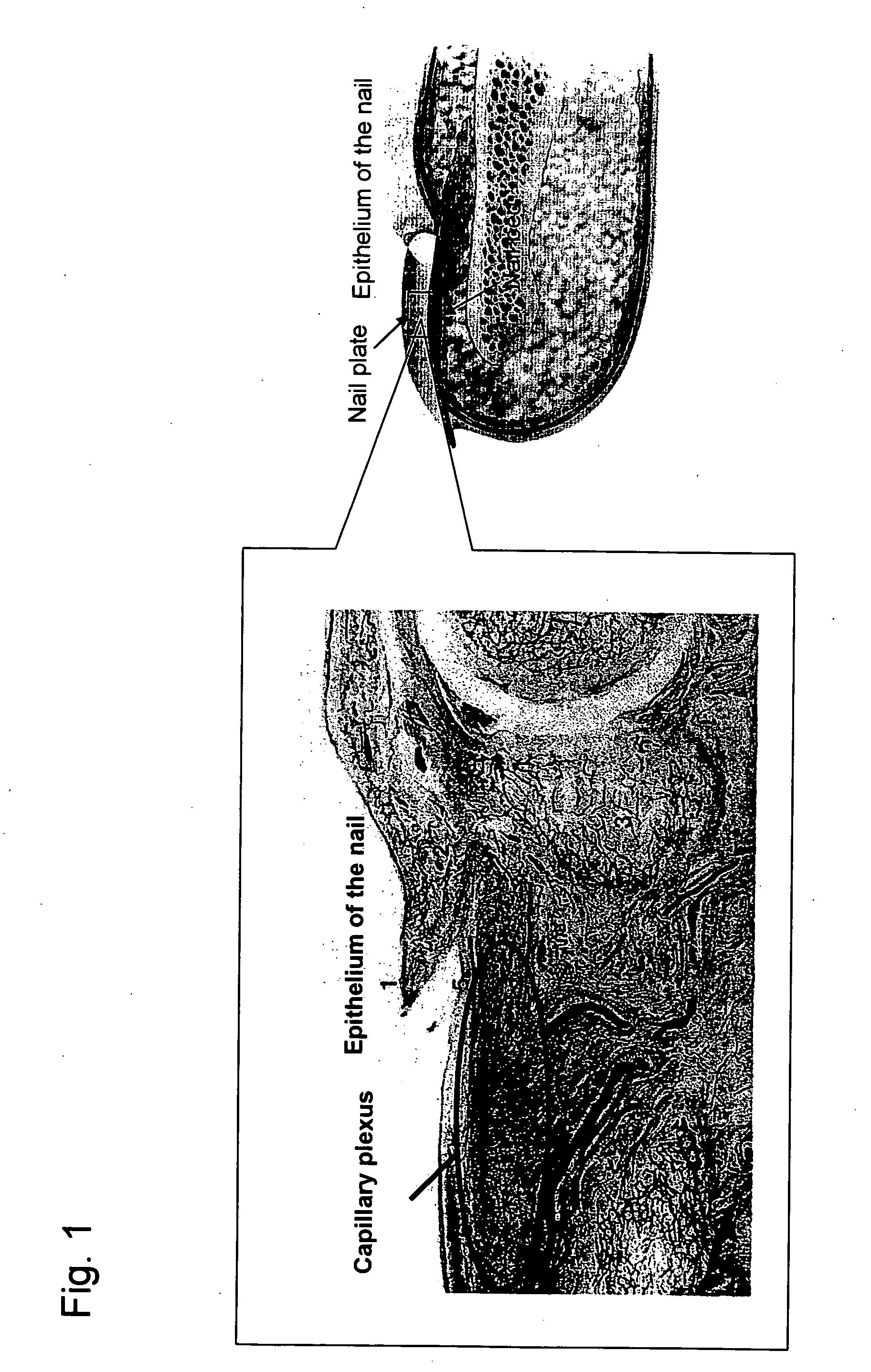 Noninvasive measuring device for substance in blood via nail and a nail evaporation device