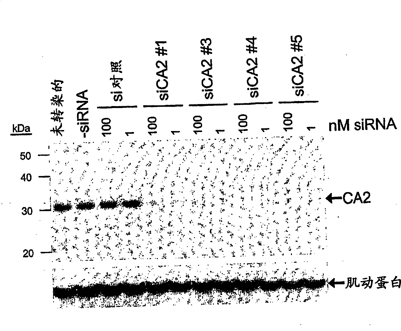 RNAI-mediated inhibition of ocular targets