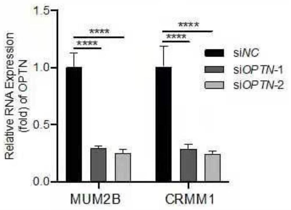 Application of Optineurin (OPTN) in diagnosis and treatment of ocular melanoma