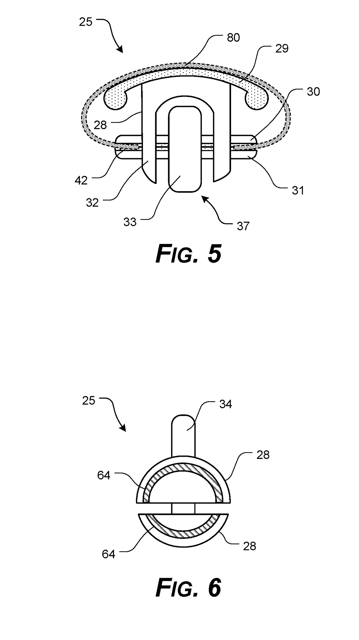 Corneal Transplant Systems, Methods, and Apparatuses