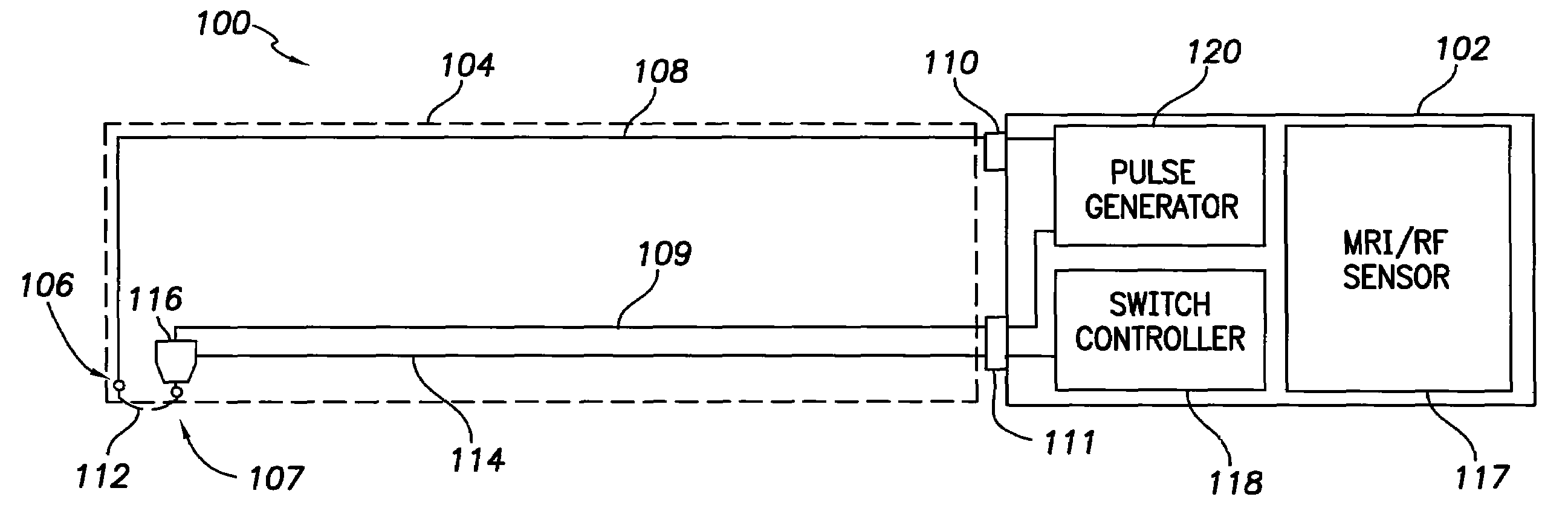 Systems and Methods for Disconnecting Electrodes of Leads of Implantable Medical Devices During an MRI to Reduce Lead Heating