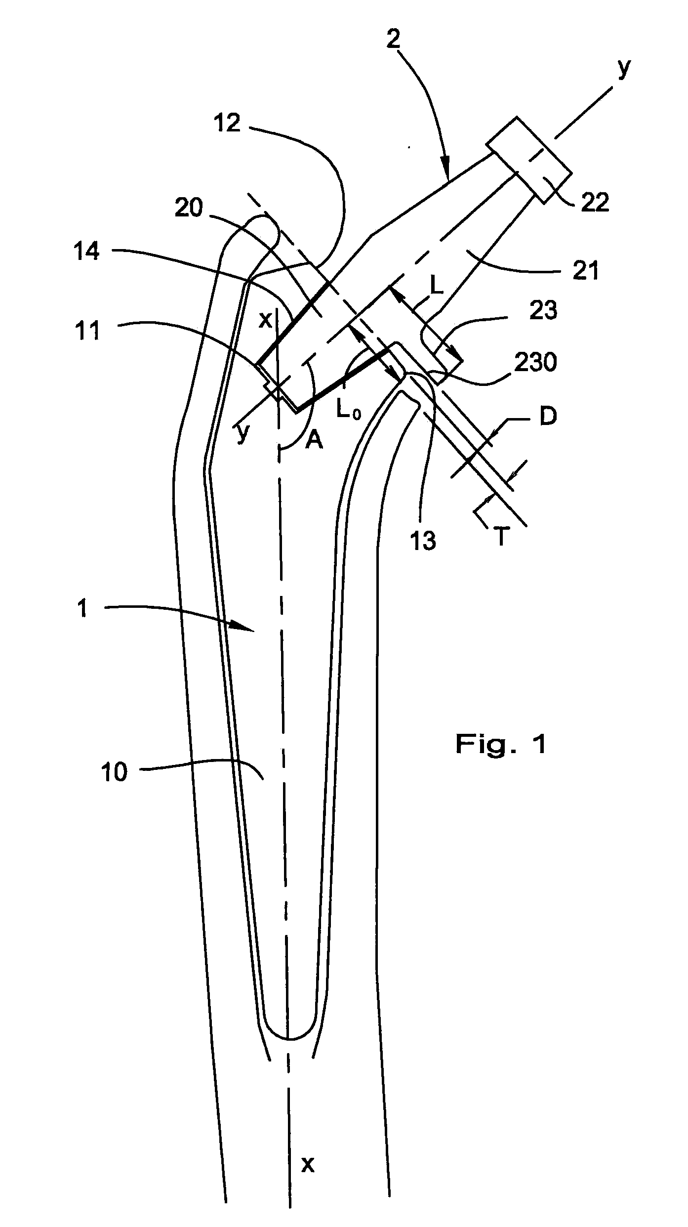 Elements of a femoral prosthesis with a modular neck, tooling for implanting a femoral prosthesis and method of implantation