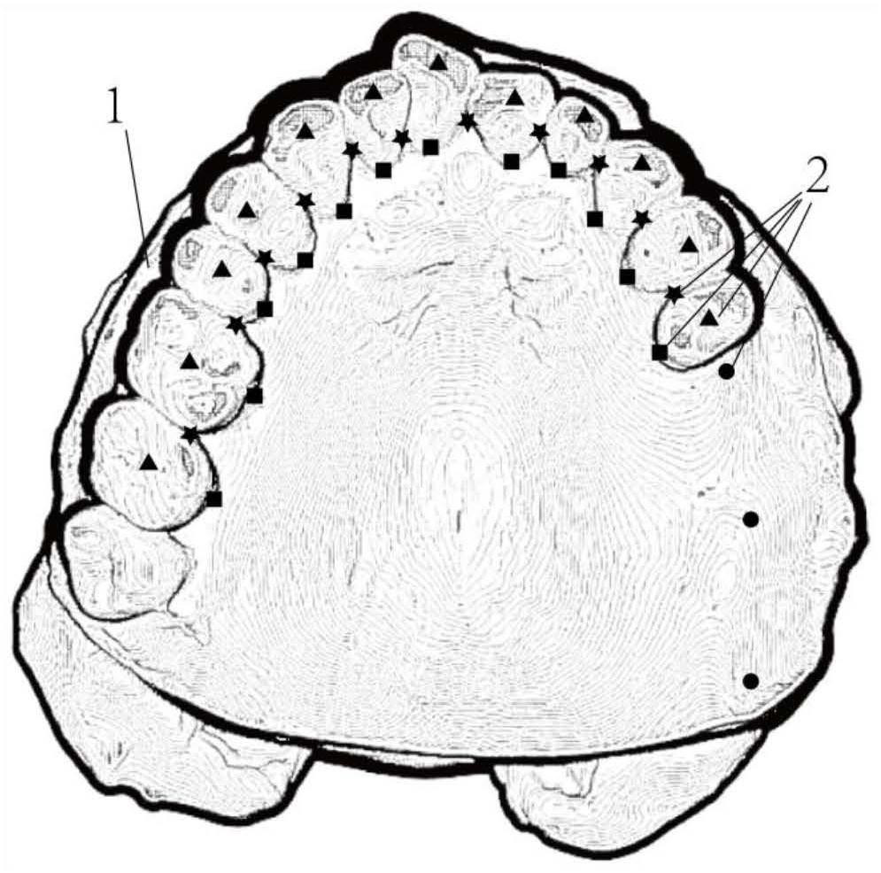 A digital design method for intraoral restorations based on big data