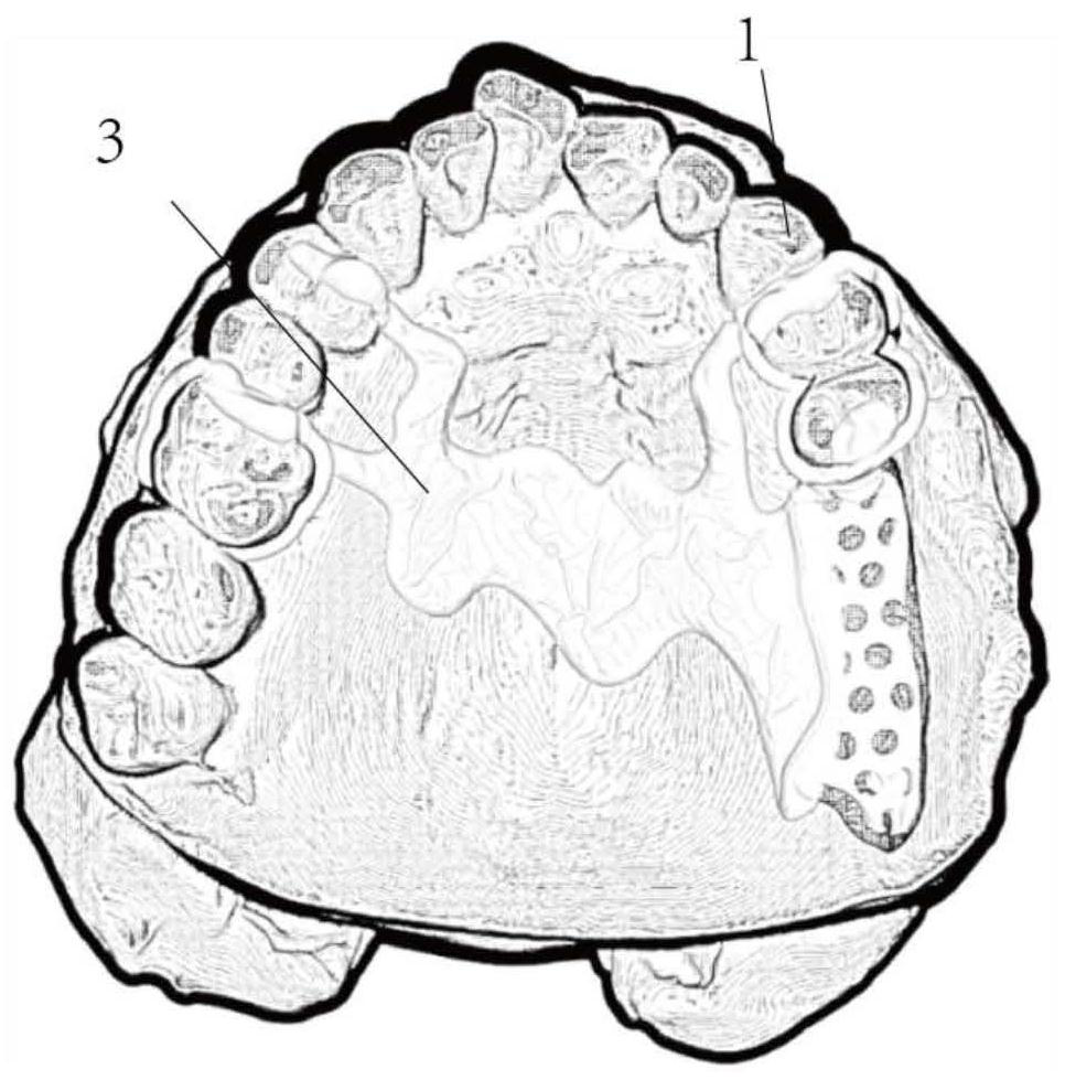 A digital design method for intraoral restorations based on big data