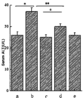Composition for improving liver function damage and application thereof