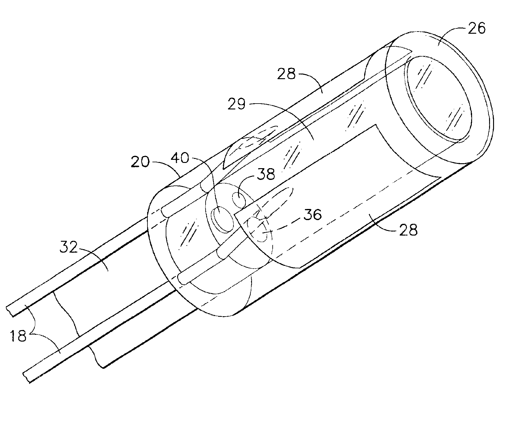 Endoscopic ablation system with improved electrode geometry