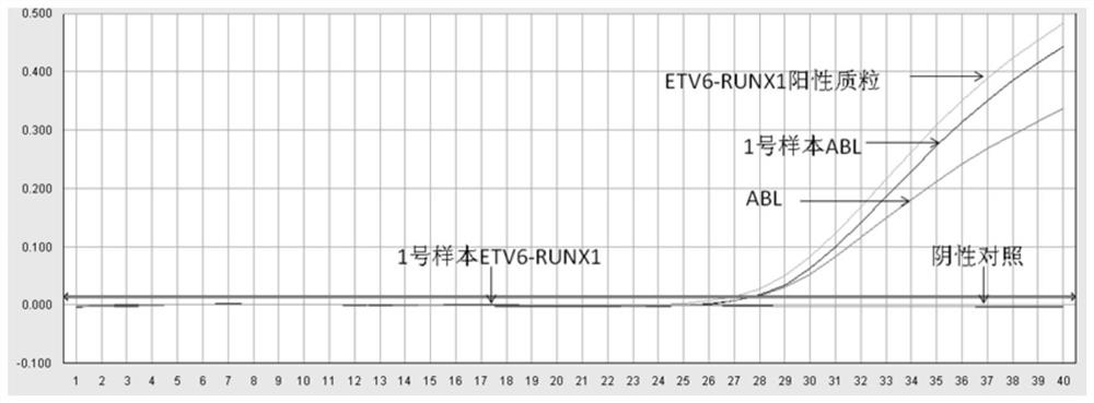 Oligonucleotide, method and kit for detecting ETV6-RUNX1 fusion gene in sample