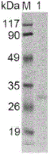 Encoding gene of keratinase and recombination expression and application thereof