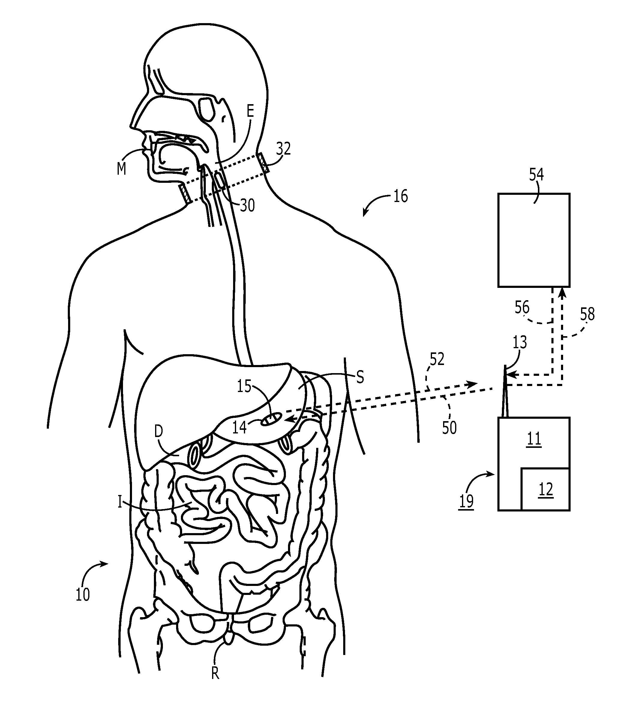 Electronic medication compliance monitoring system and associated methods