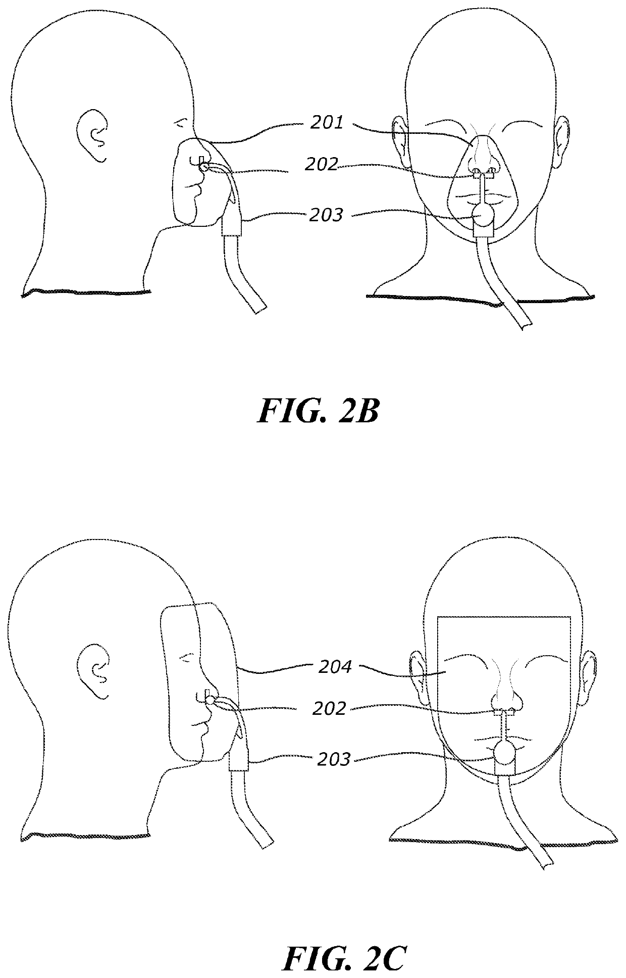 System and method for non-invasive ventilation