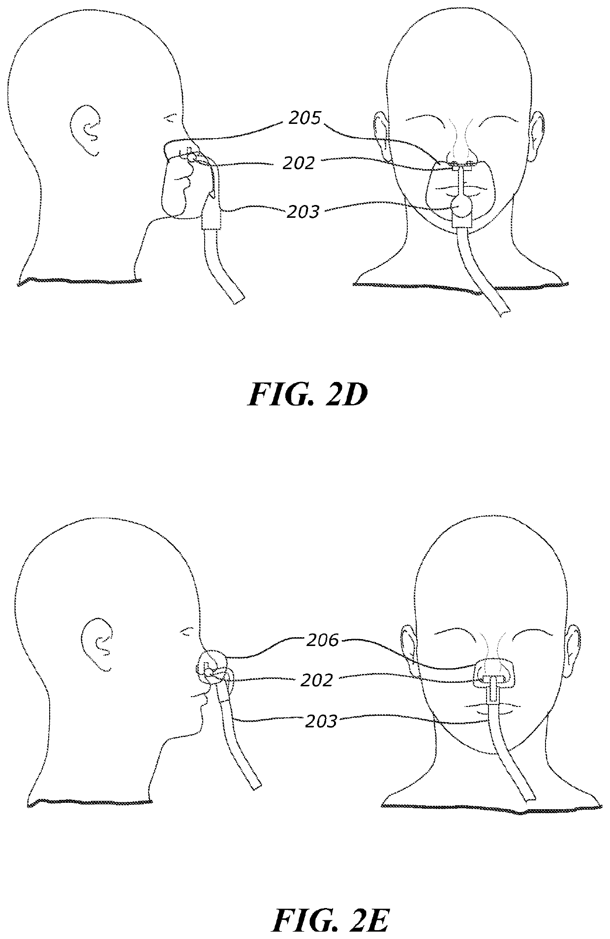 System and method for non-invasive ventilation