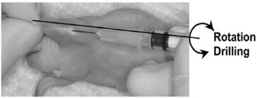 Method for preparing in-situ and pulmonary metastasis tumor model through intra-tibial injection
