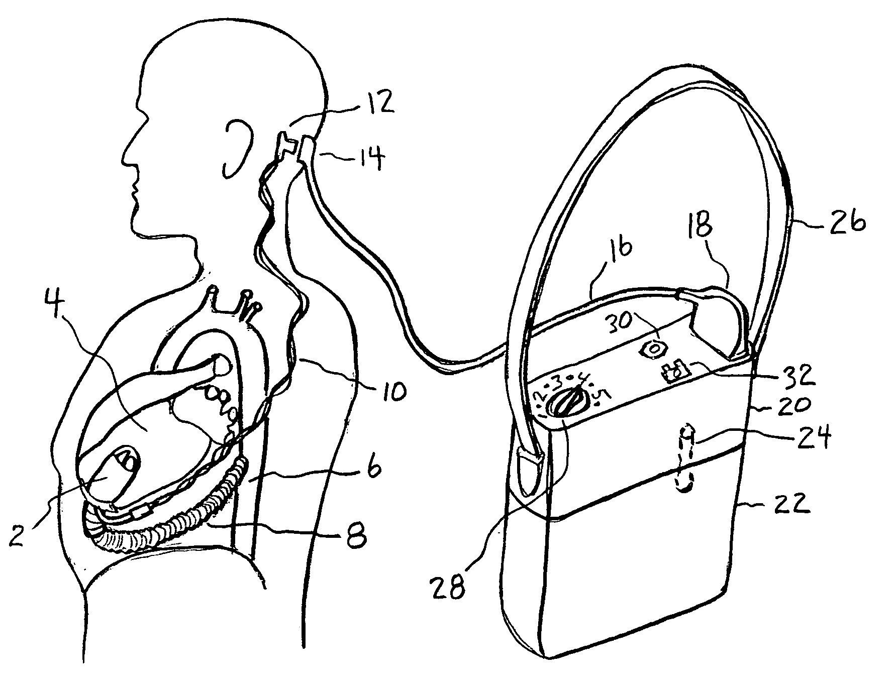 Artificial heart power and control system