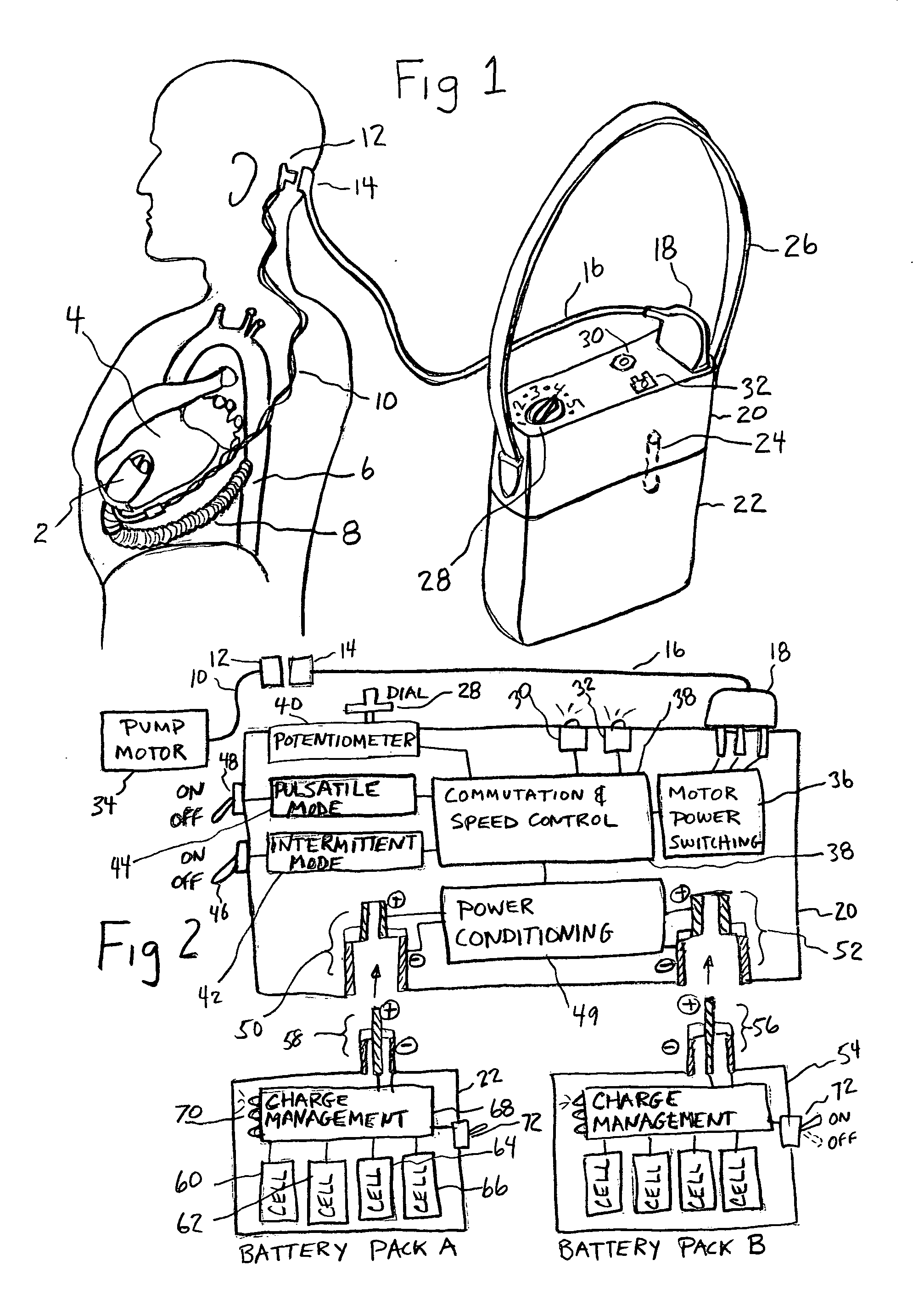 Artificial heart power and control system
