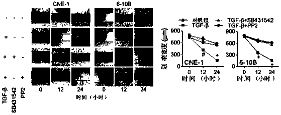 Flotillin-2 as a target for screening drugs that inhibit the metastasis of nasopharyngeal carcinoma and its application