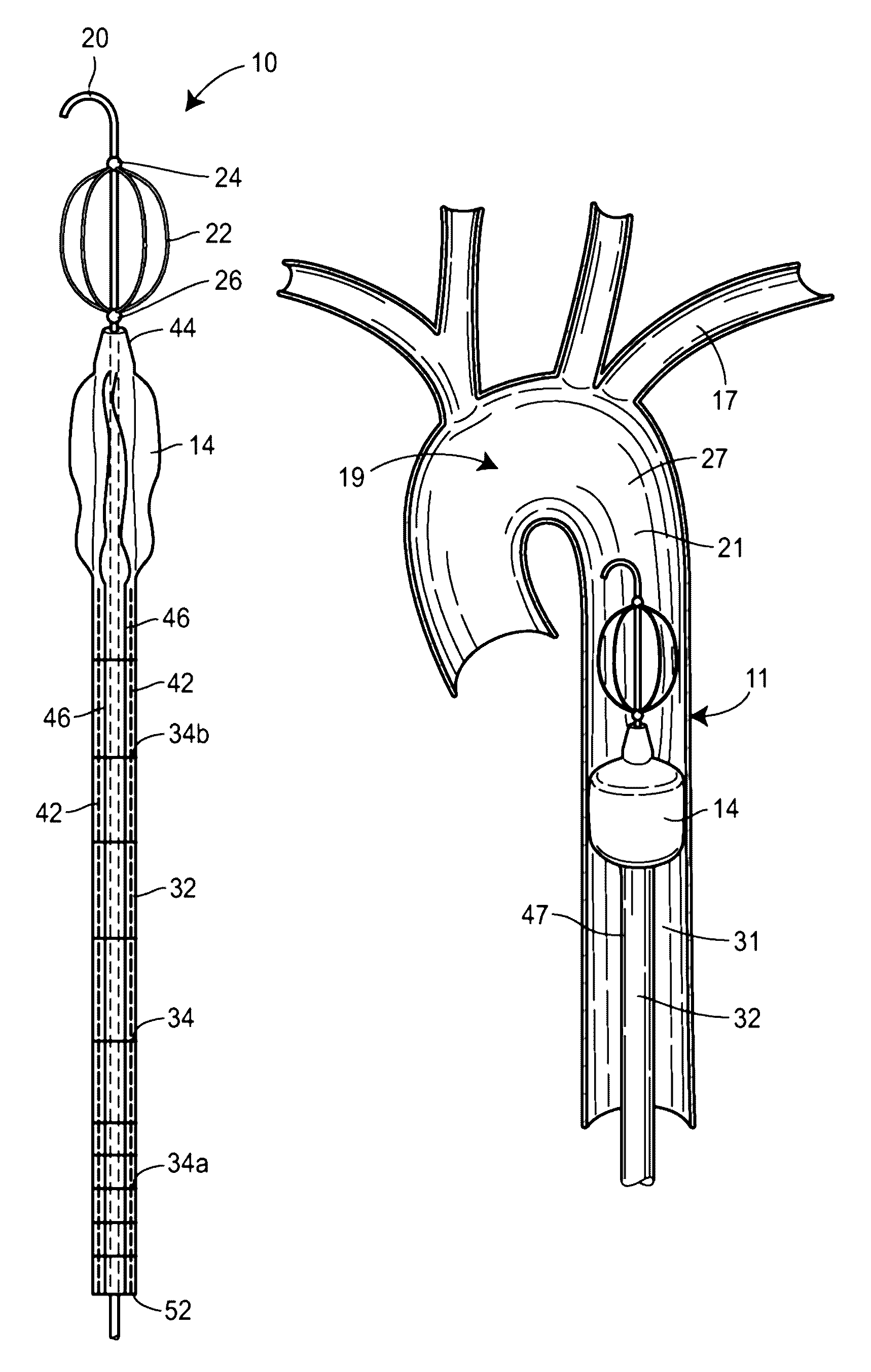 Fluoroscopy-independent balloon guided occlusion catheter and methods