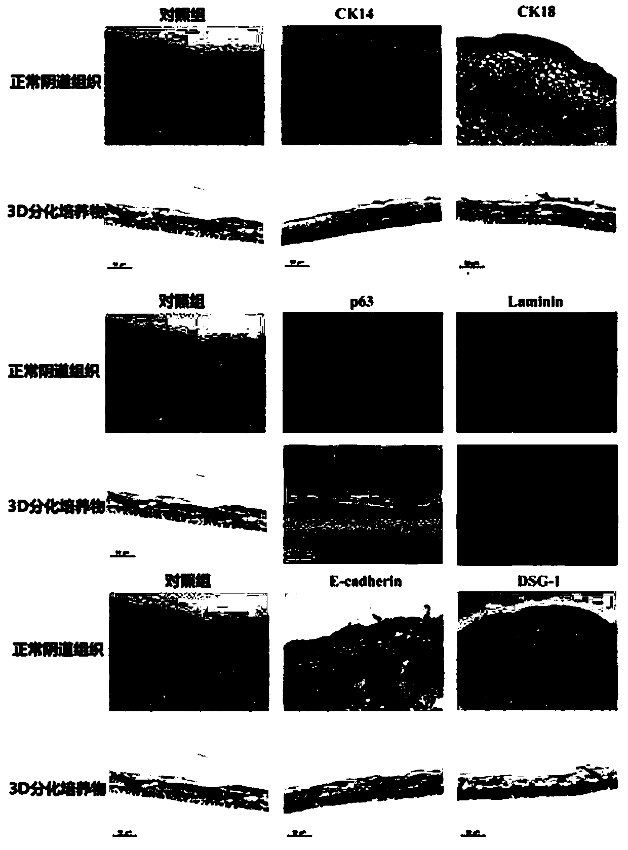 A construction method and application of a human normal vaginal epithelial 3D differentiation culture model