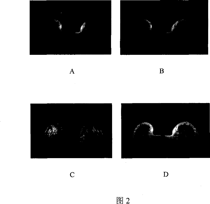 Tissue separation imaging method based on inversion recovery