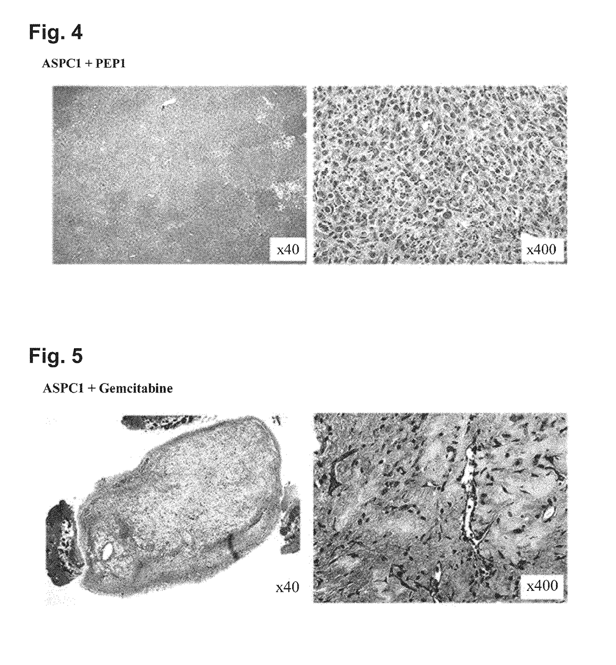 Peptide having fibrosis inhibitory activity and composition containing same