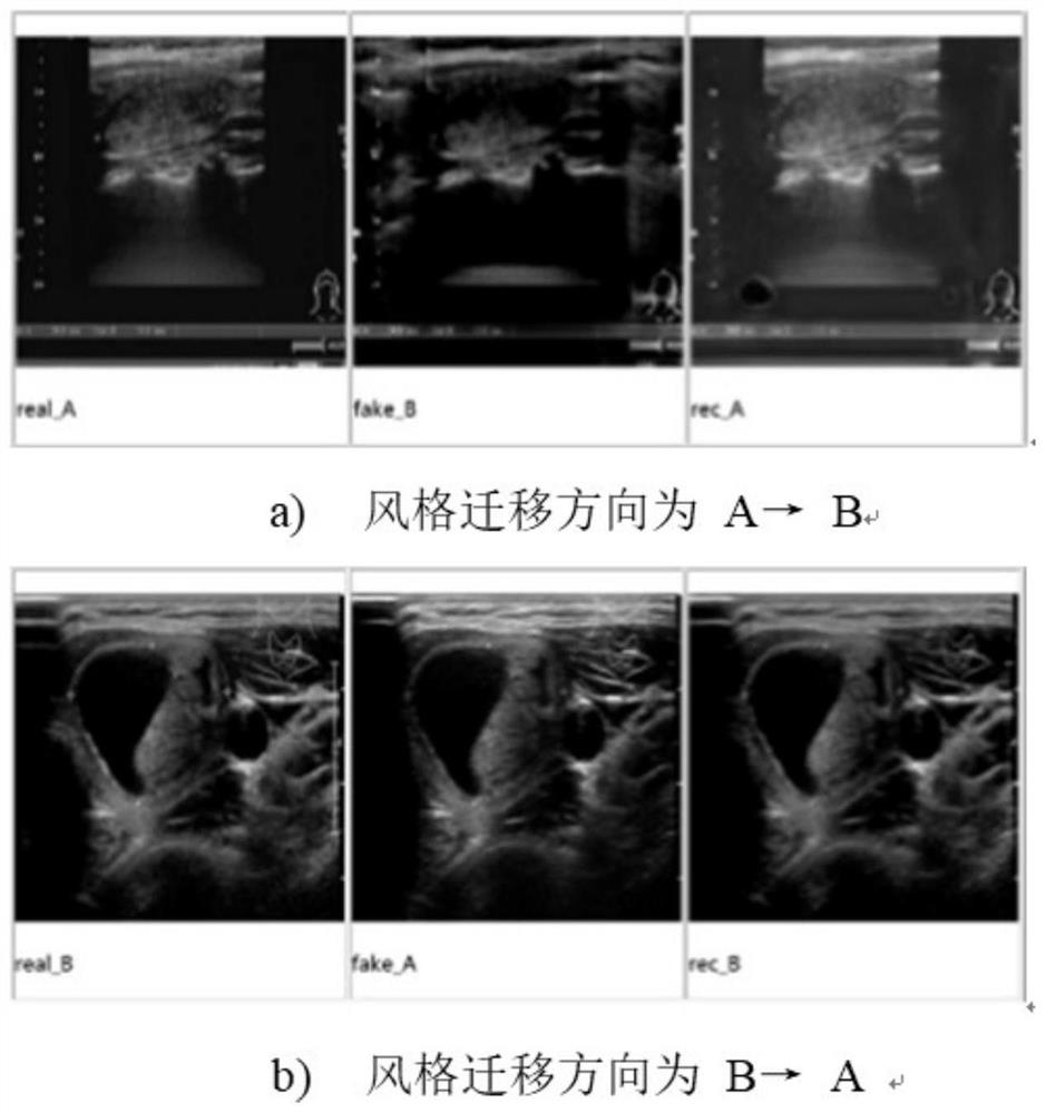 A method for clustering and style migration of ultrasound images