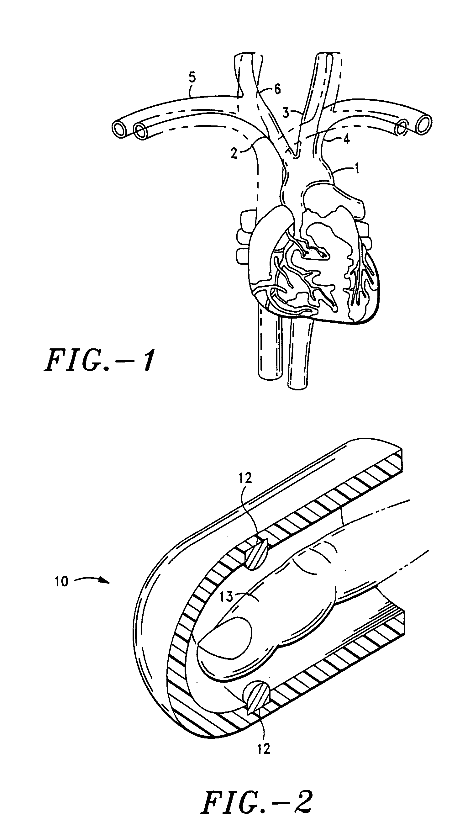 Device and method for noninvasive continuous determination of physiologic characteristics