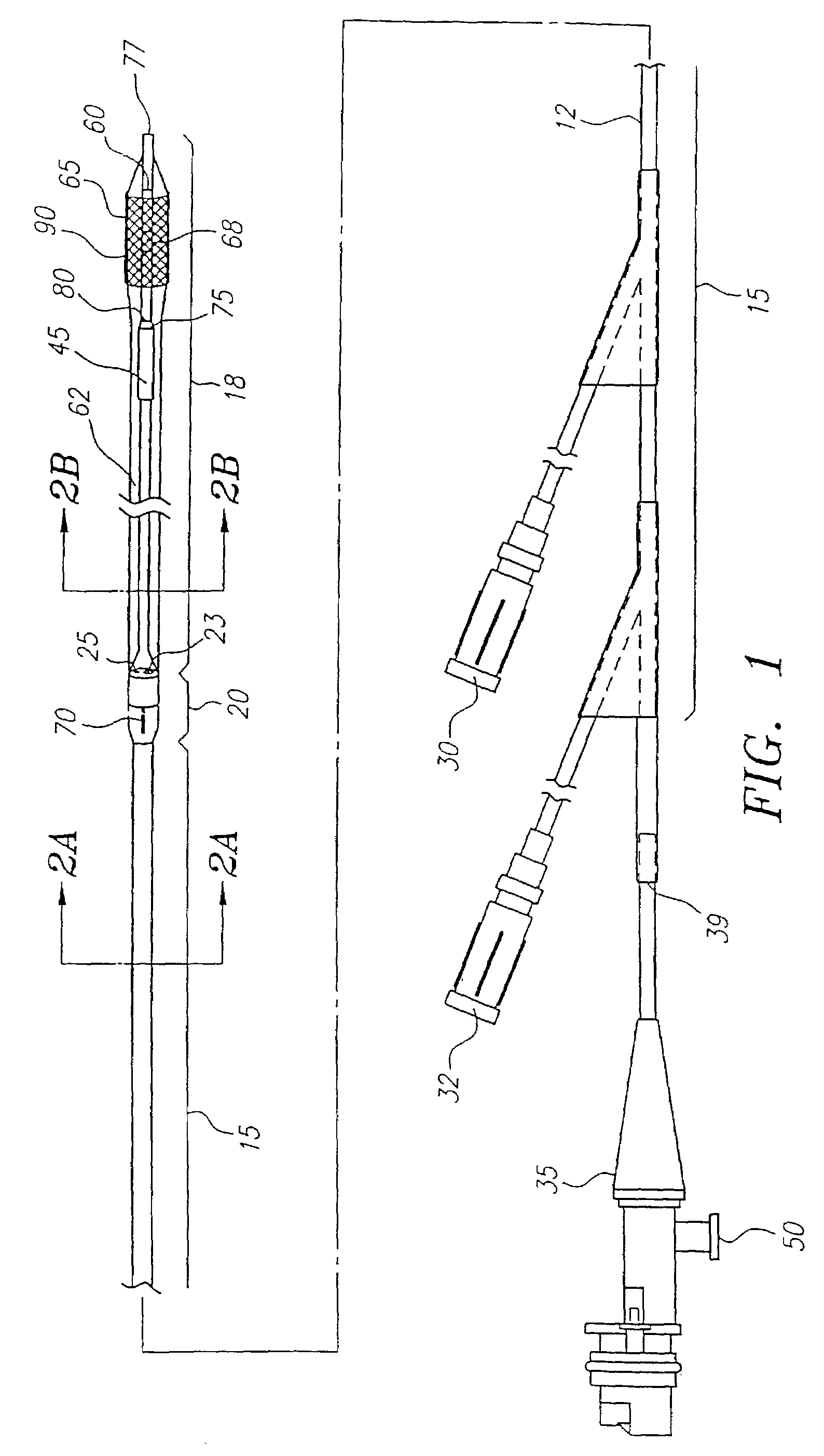 Catheter system having imaging, balloon angioplasty, and stent deployment capabilities, and method of use for guided stent deployment
