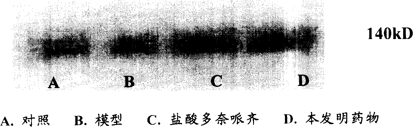 Medicine for treating senile dementia and preparing method thereof