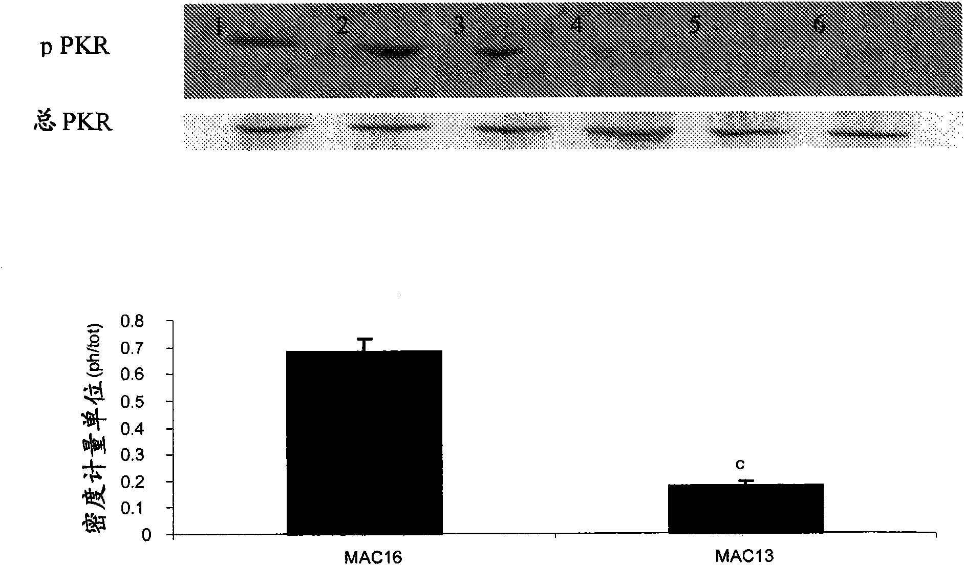 Compositions and methods for inhibiting the activation of dsRNA-dependent protein kinase and tumor growth inhibition